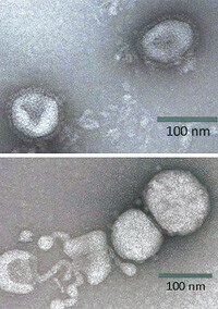 表面がスパイクで覆われたウイルス粒子(写真上)。スパイクでヒトの細胞に取り付いたり、細胞の中から出たりする。センダン抽出液を加えるとスパイクが消え、ウイルス粒子の一部が壊れた(同下)。ちなみに、「栴檀は双葉より芳し」の諺で知られるのは白檀のことで、ここでのセンダンとは別物。