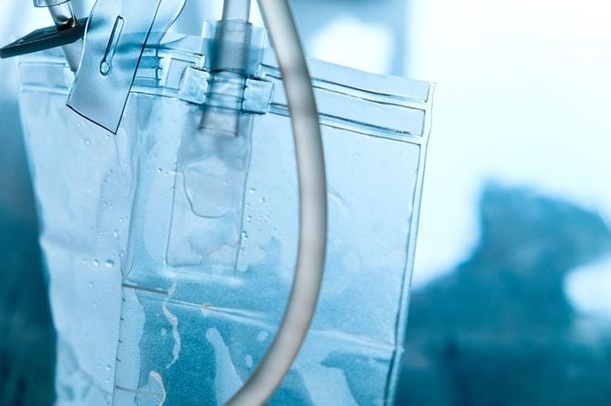 患者さんのベッド脇に吊るされた尿袋