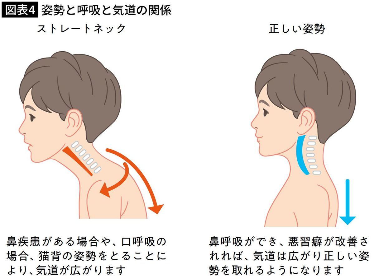 【図表4】姿勢と呼吸と気道の関係