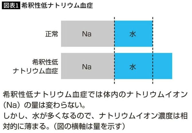 希釈性低ナトリウム血症