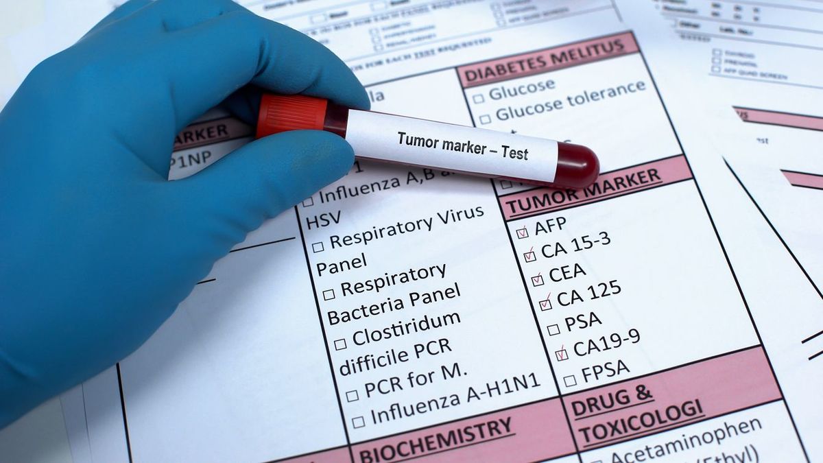 腫瘍マーカーの血液検査