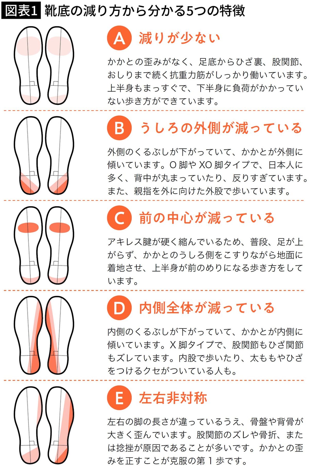 【図表1】靴底の減り方から分かる5つの特徴