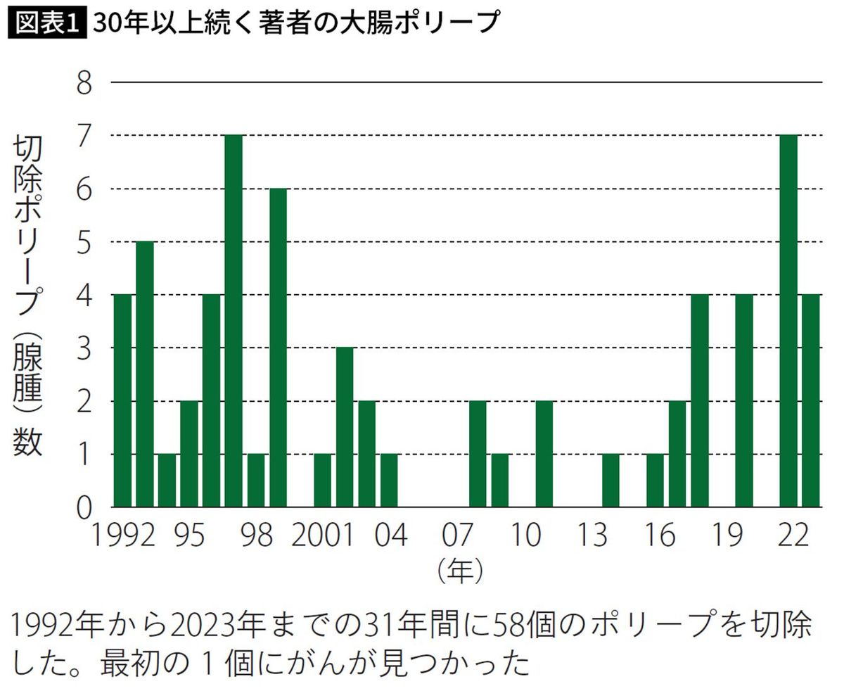 30年以上続く著者の大腸ポリープ