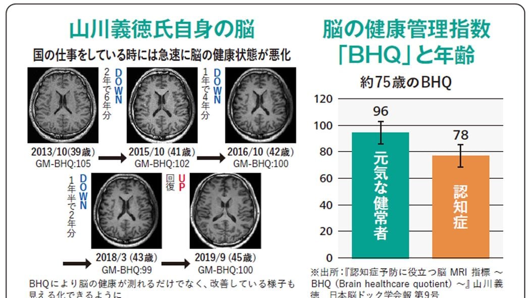 脳科学者が全力でお勧め! ｢本当に脳年齢が若返る｣生活習慣のコツ