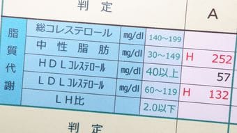 悪玉コレステロールが高いほうが｢がんやうつ病に強い｣…和田秀樹が｢健康診断を気にするな｣という理由