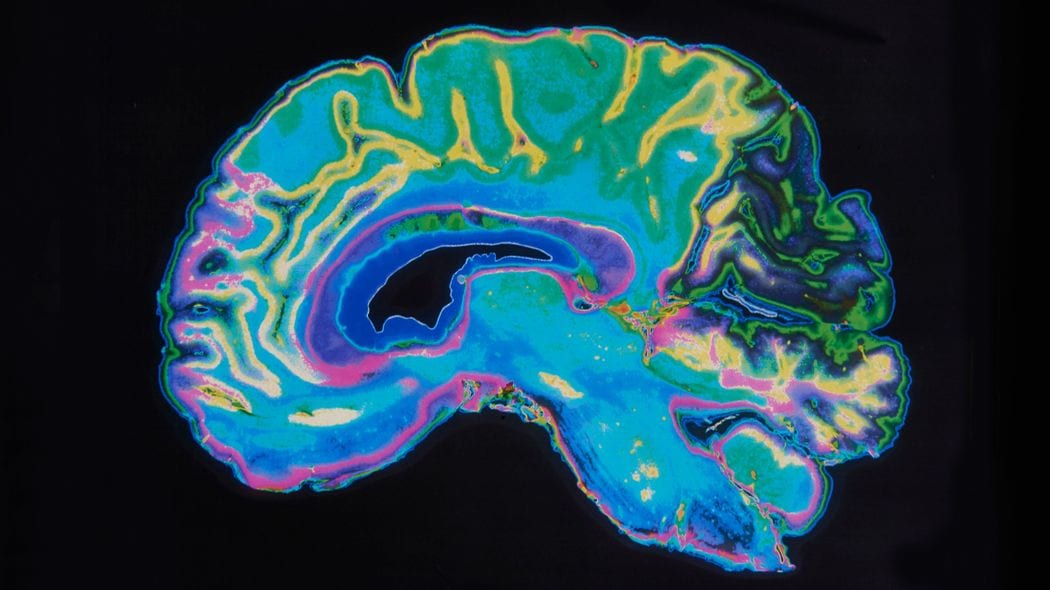 台所の流しに大便がコロコロ転がっていた…徘徊癖のある若年性認知症の妻が起こした"クリスマスイブの奇跡" 感情表現も記憶もなくし､摘便が必要なときもある妻を愛し続ける理由