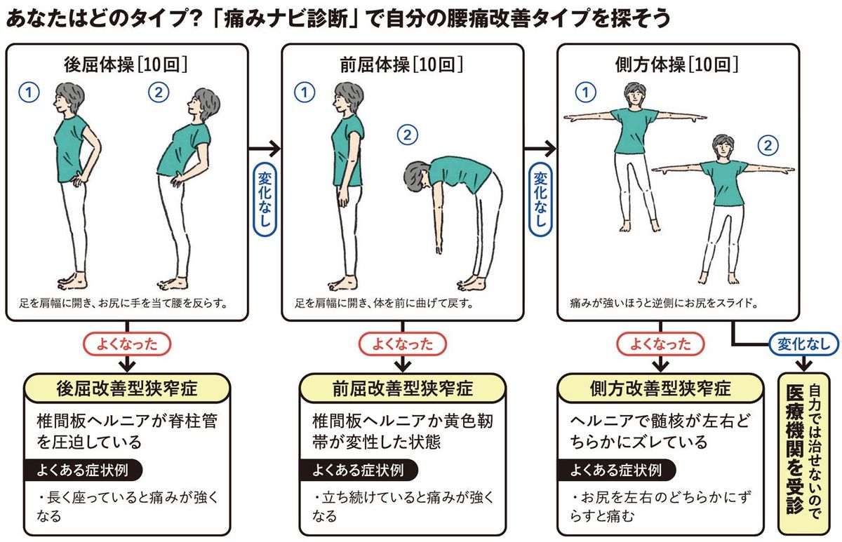 脊柱管狭窄症､椎間板ヘルニア､ぎっくり腰､変形性腰椎症､筋・筋膜性腰痛