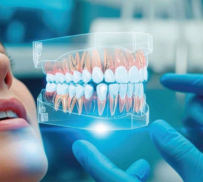 歯科治療のイメージ