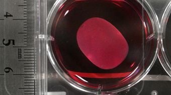 1回3億円超の薬価を国民全員で背負うことになる…｢日本発で世界初のiPS再生医療｣を手放しで喜べない理由