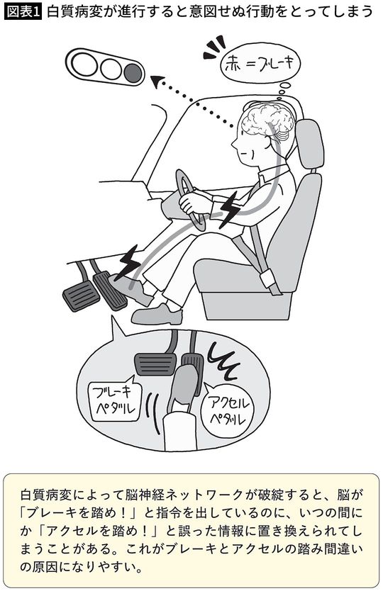 【図表1】白質病変が進行すると意図せぬ行動をとってしまう