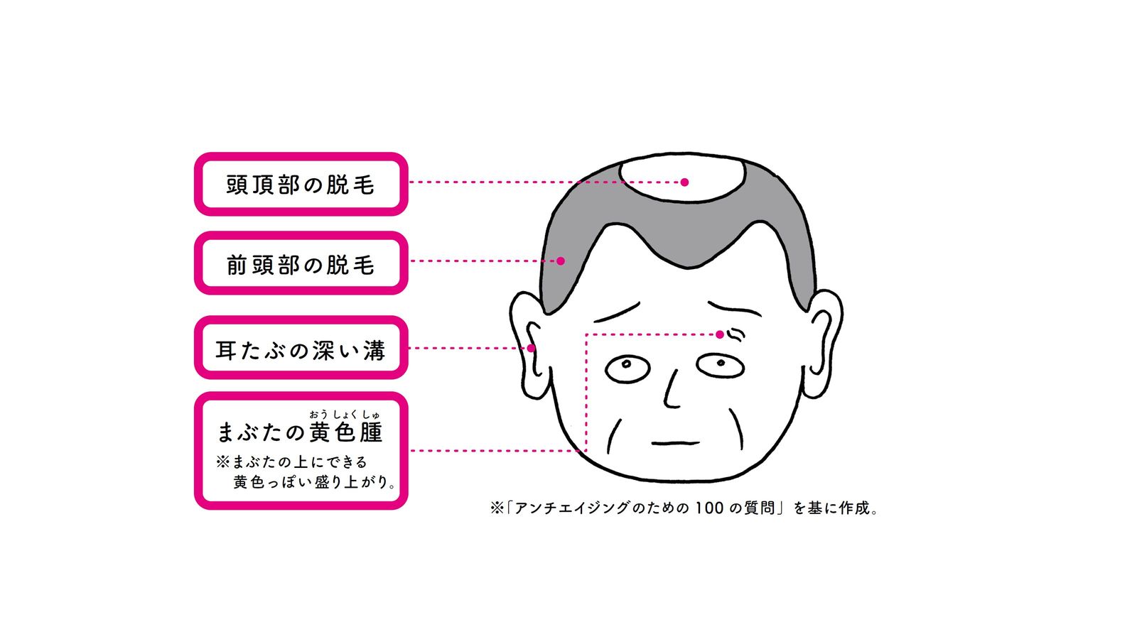 死亡率約2倍､心筋梗塞のリスク上昇｢老け顔｣の人は体の中身も老けている シミ･くすみ･たるみ･耳たぶ･まぶた