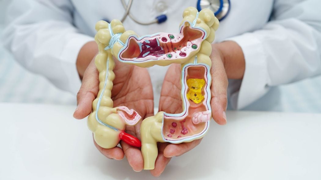 ステージIなら5年後の生存率は9割…内科医｢40歳から毎年受けて｣､自宅でできる大腸がん検査の名前