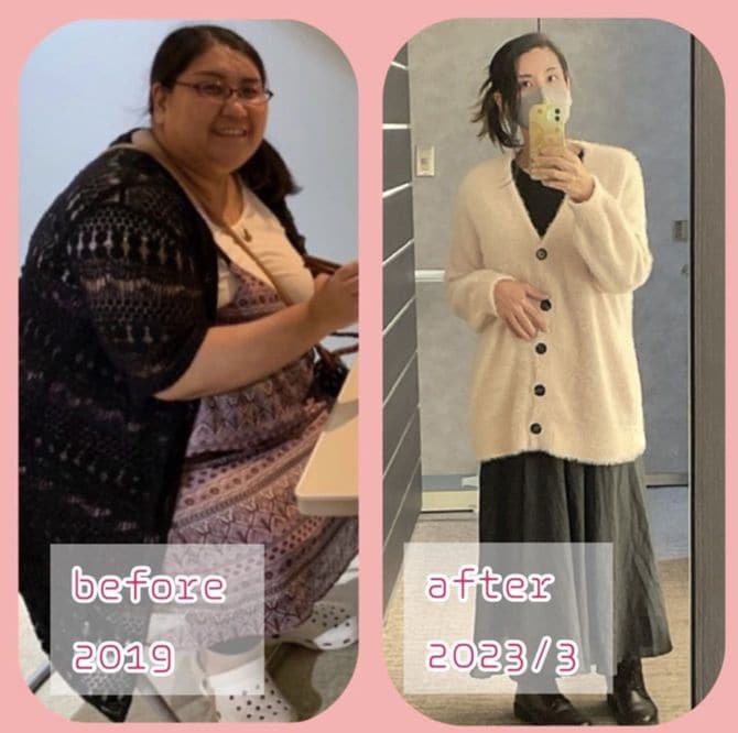 ダイエット前後のるはちさん