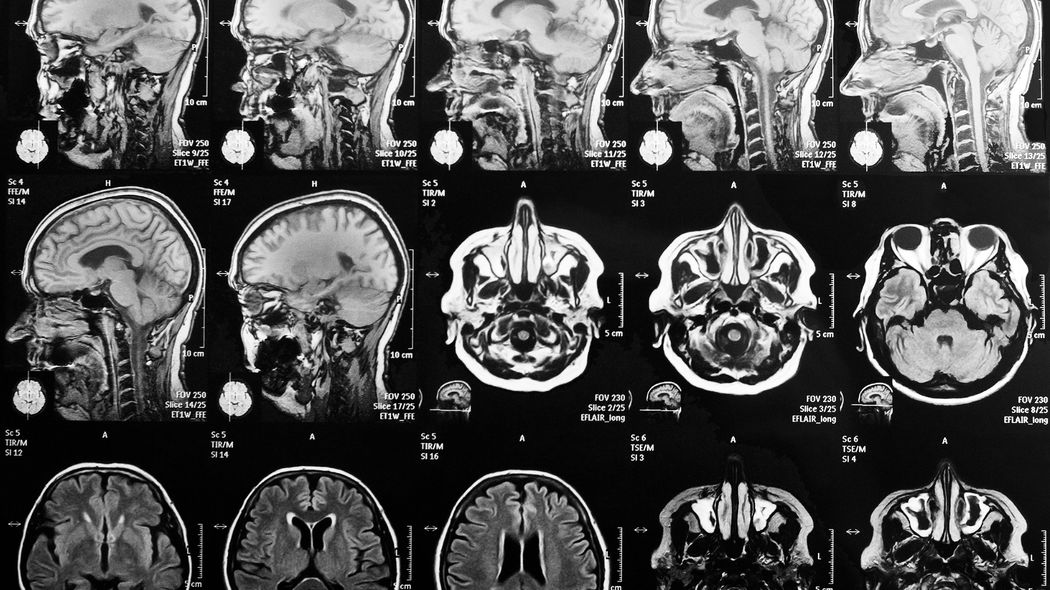｢検査する意味がないのでしません｣70代認知症の母を献身介護する娘が天を仰いだ医師の冷酷診断の背景 社交的で明るかった母親は娘の名前さえ忘れてしまった