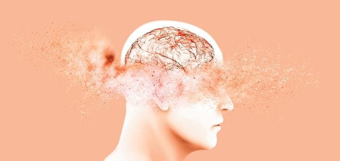 記憶が消えていくイメージ