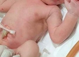 分娩室でくっきり"器の大きい人小さい人" 「ビデオは産まれるまで禁止です」