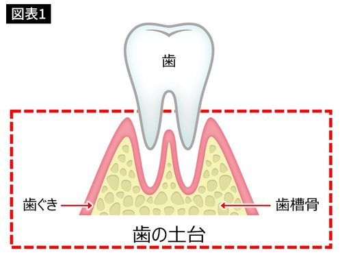 歯の土台