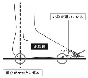 体を十分に使わないことで、足の小指が地面につかない「浮き指」の子どもが増えている……