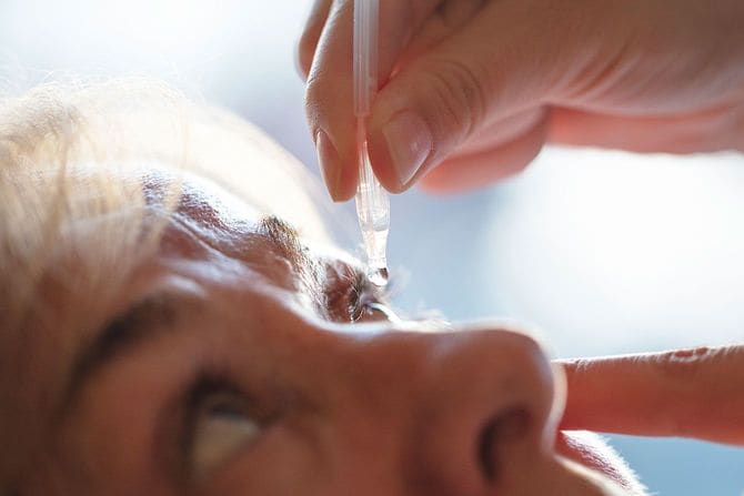 患者の目に目薬をさす医師