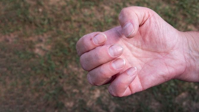 手入れされていない手元のアップ