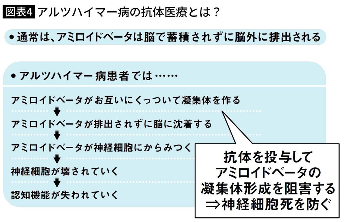 アルツハイマー病の抗体医療とは？