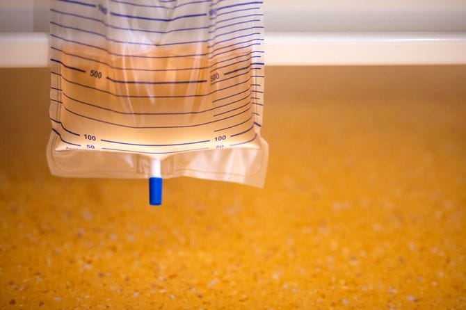 病院のベッドから吊り下げられた尿袋