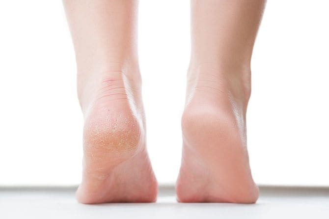 かかとが浮いている様子