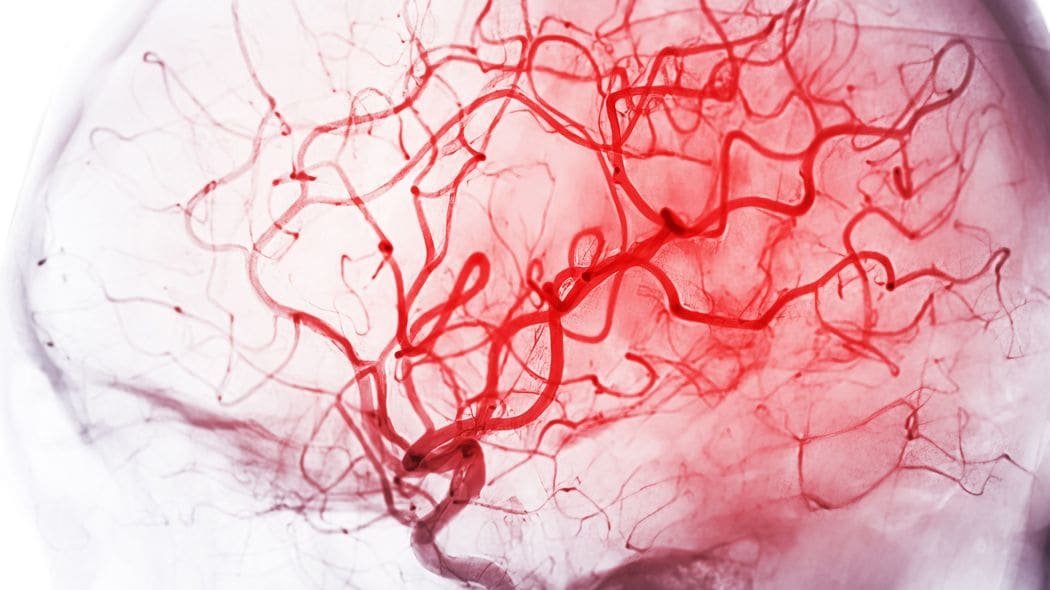 ずっと鼻声＆急に字が下手になる不気味な症状…67歳妻が身勝手で目が離せない不治の夫を愛し通せたワケ 24時間目が離せない夫と､寝たきり80代母のダブル介護