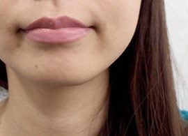 なぜ、“1分1800円”の唇美容にハマる女子が多いのか