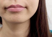 なぜ、“1分1800円”の唇美容にハマる女子が多いのか