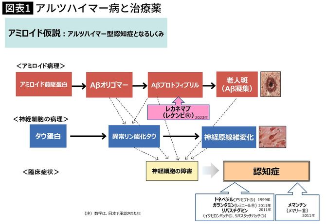 アルツハイマー病と治療薬