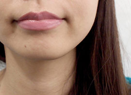なぜ 1分1800円 の唇美容にハマる女子が多いのか President Online プレジデントオンライン
