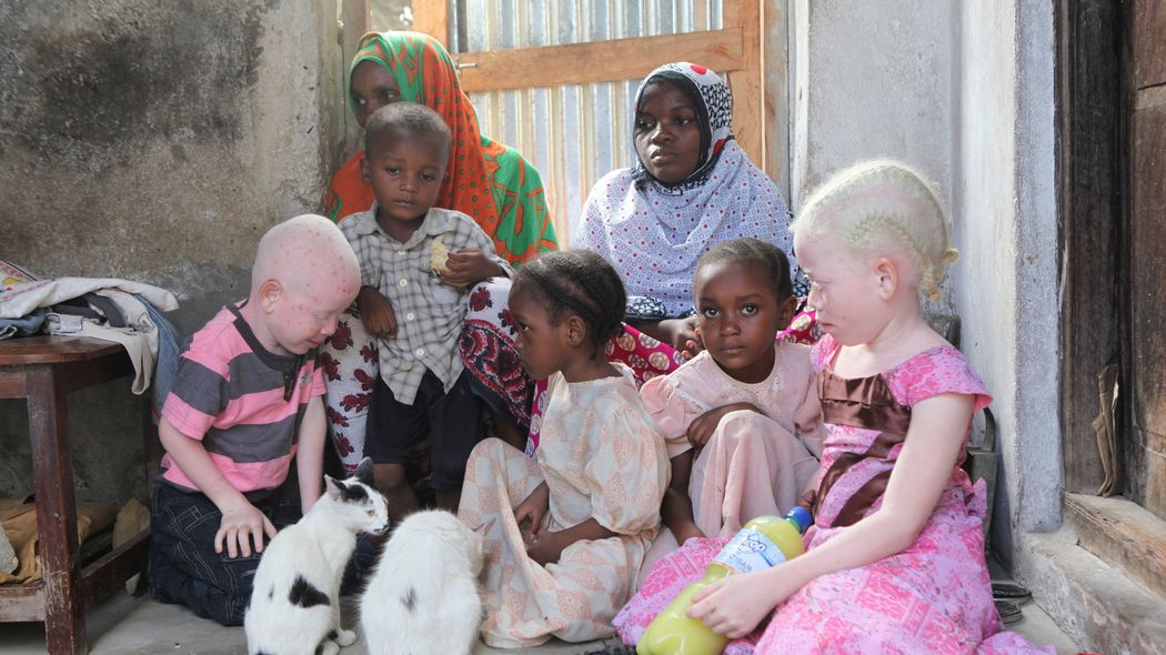 連載･伊藤詩織｢アルビニズムの少年少女の人身売買が行われるアフリカの闇市｣ 柔軟に個人を尊重できる世界を祈る