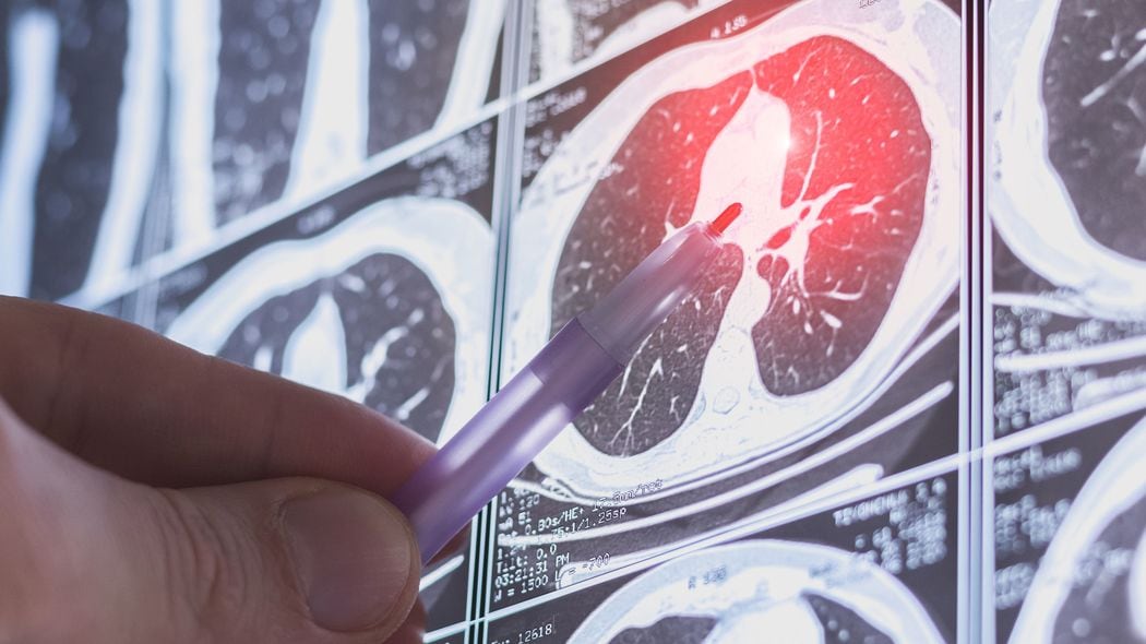 アルツハイマー病から｢逃げおおせなかった老親｣を狙い撃ち…通帳をゼロにしたハイエナ保険会社の人間失格 強引な営業で月6万円の死亡保険･入院保険に加入させられていた