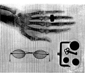 島津が日本で最初に成功させたレントゲン写真