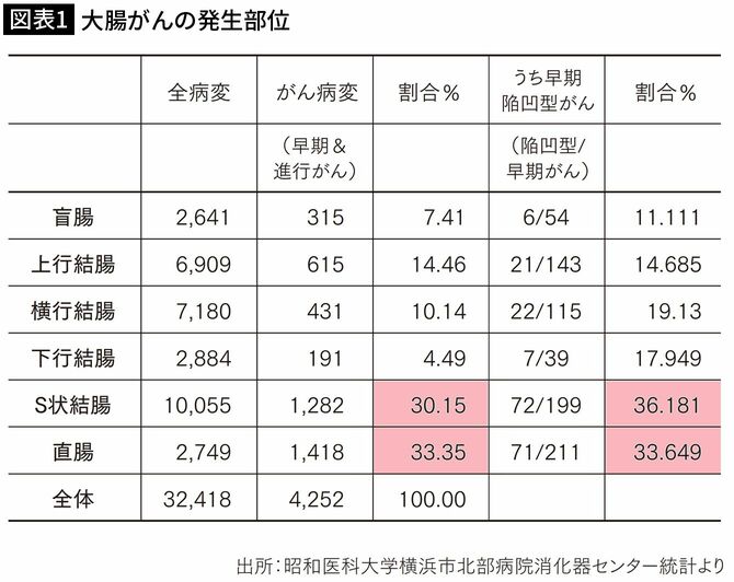 【図表1】大腸がんの発生部位