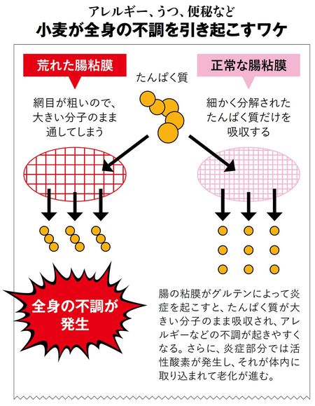 【図表】小麦が全身の不調を引き起こすワケ