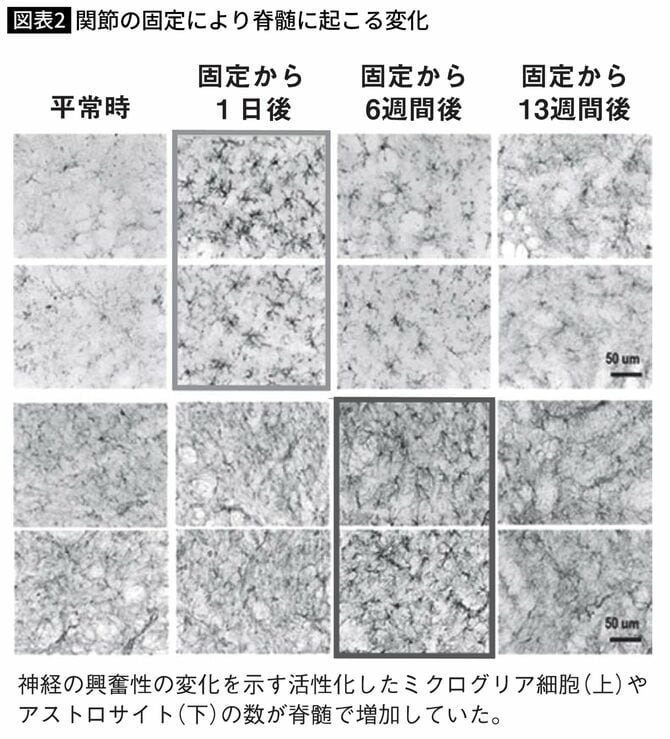間接の固定により脊髄に起こる変化