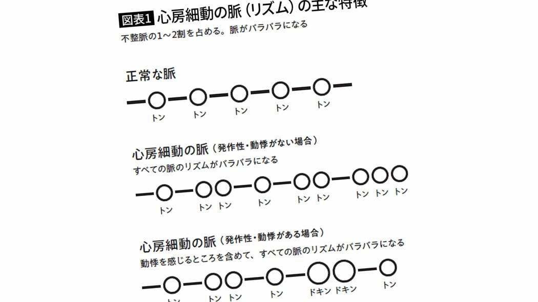 ｢トン-トントン｣と乱れる脈に要注意…長嶋茂雄､小渕恵三元総理の脳梗塞につながった｢心房細動｣の危険信号