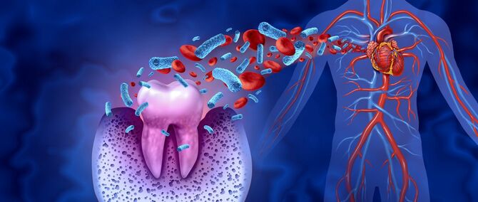 歯周病菌や炎症性サイトカインが血液にのって全身へ運ばれるイメージ