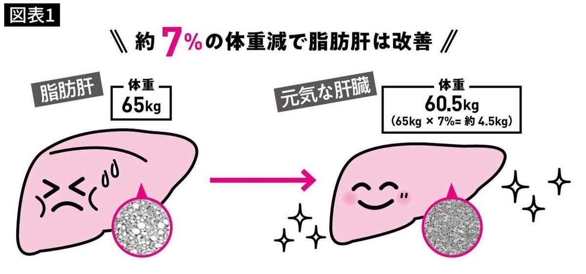 約7％の体重減で脂肪肝は改善