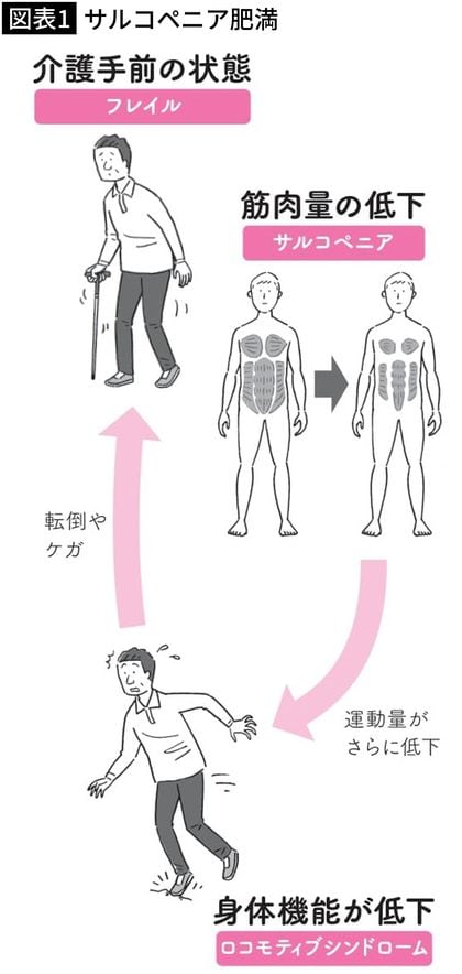 【図表1】サルコペニア肥満