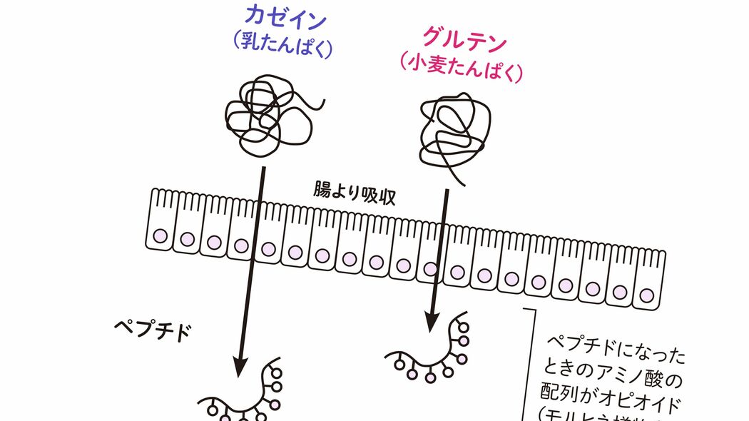 片頭痛にメンタル不調…子供の｢原因不明の体調不良｣に医師が｢いちど摂取をやめてみて｣という冷蔵庫常備品 腸内環境を整えているつもりが､アレルギーリスクを高めている
