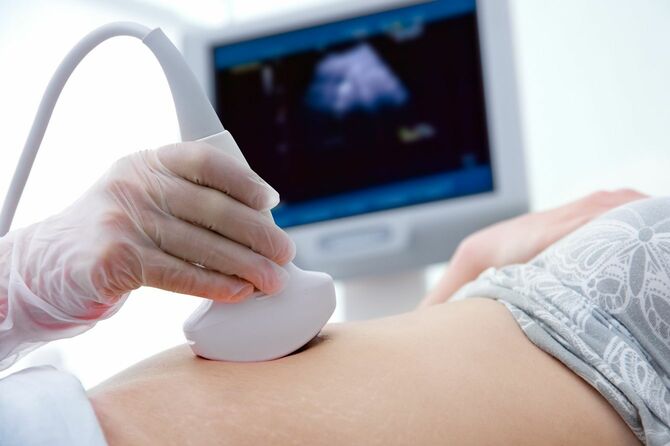 妊婦健診で超音波検査