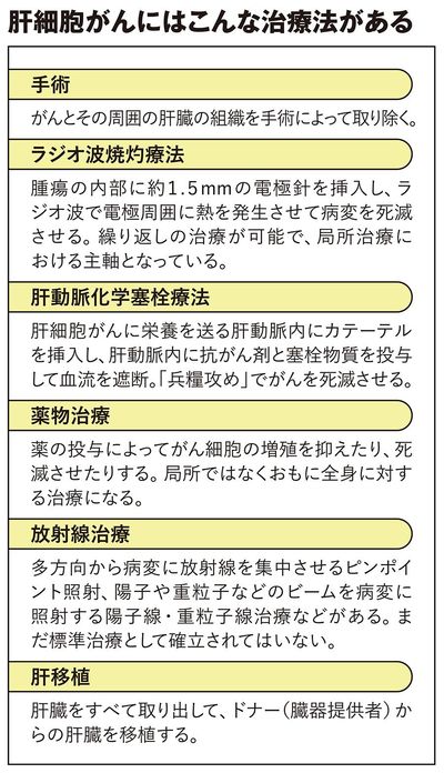 【図表】肝細胞がんにはこんな治療法がある