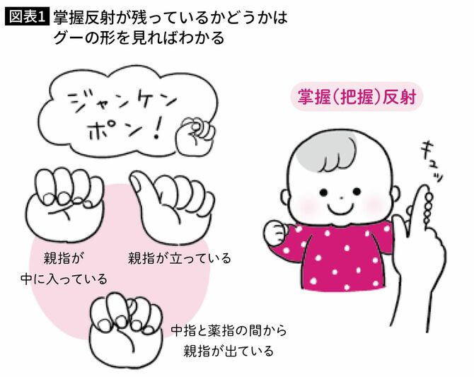 掌握反射が残っているかどうかはグーの形を見ればわかる