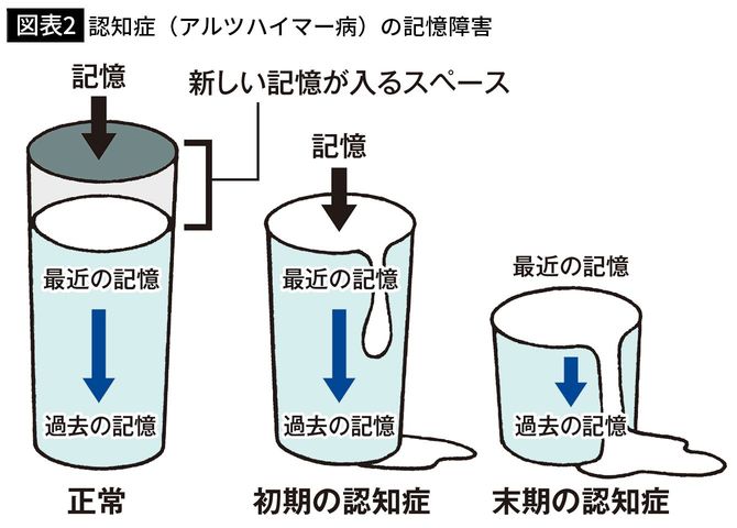 【図表2】認知症（アルツハイマー病）の記憶障害