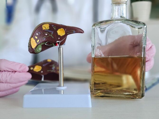 酒のボトルと肝臓の模型を示す医師