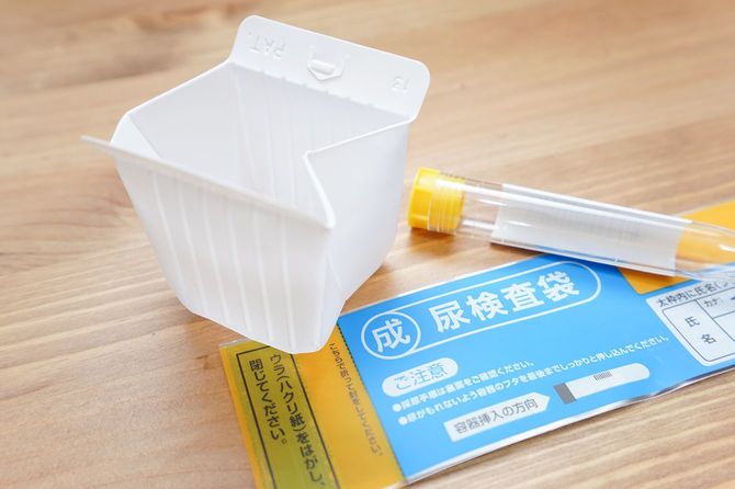 「小学校の尿検査が怖くて仕方なかった」（※写真はイメージです）