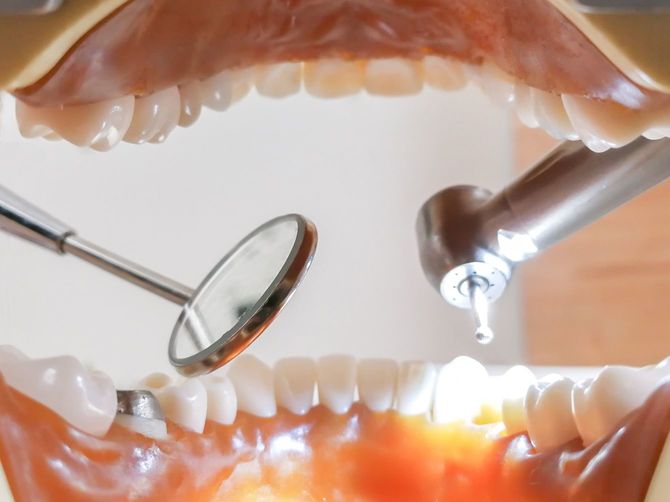 口の中から見た歯科治療のイメージ